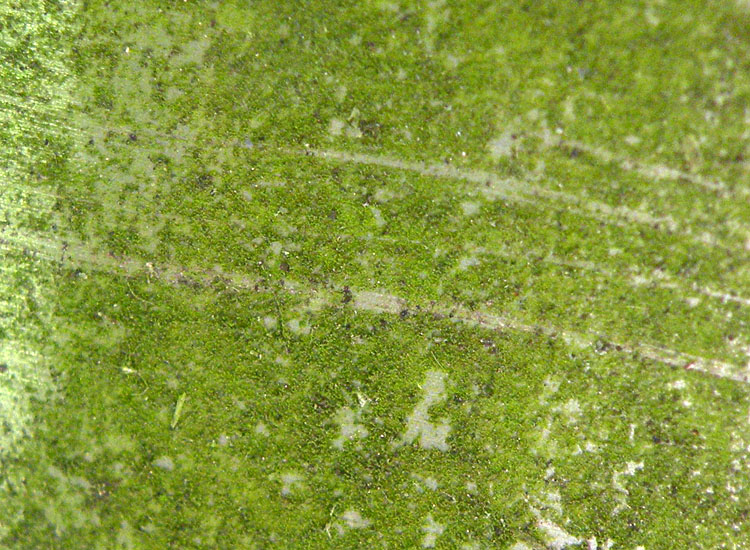 Microalga terrestre: Trebouxia sp